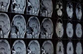 Our Brains Include Lithium—and Its Loss Would possibly Assist Drive Alzheimer’s, Examine Finds